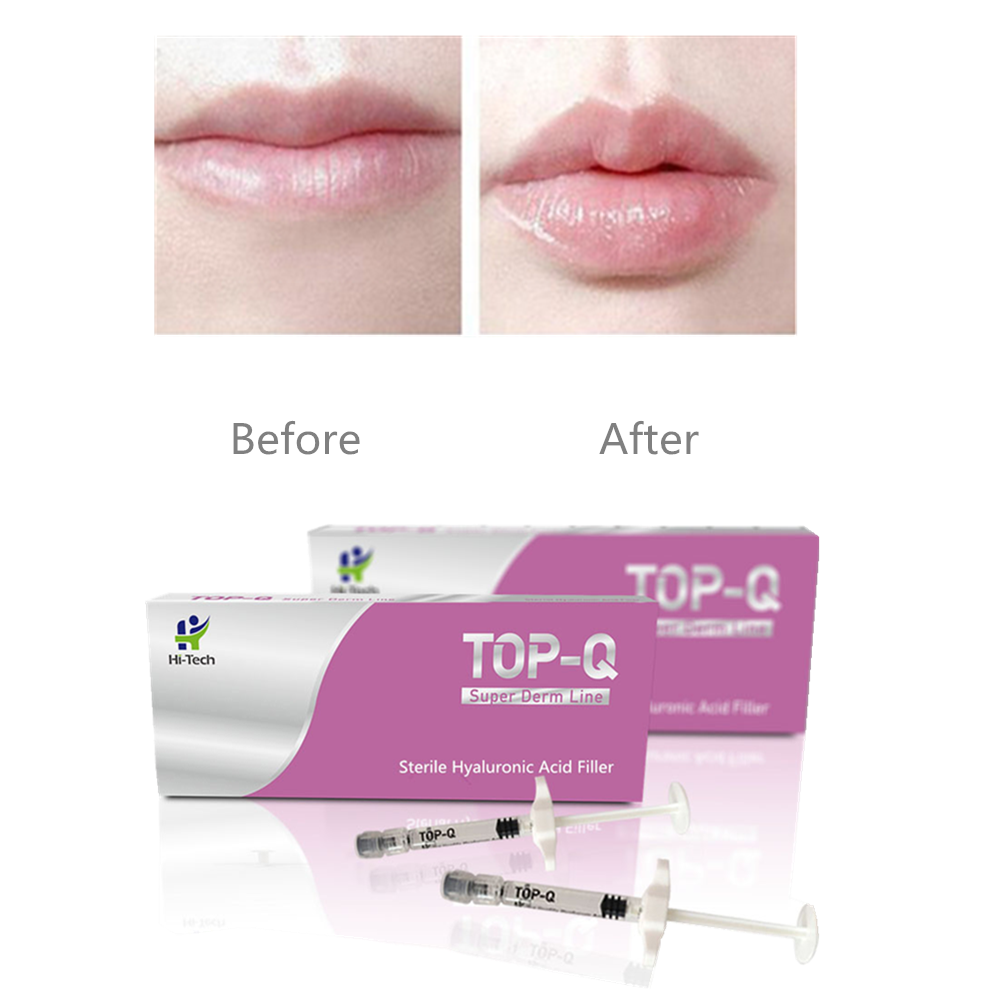 TOP Q Super Derm Line 2ML Hyaluronic Acid Lip Enhancement Gel Injector