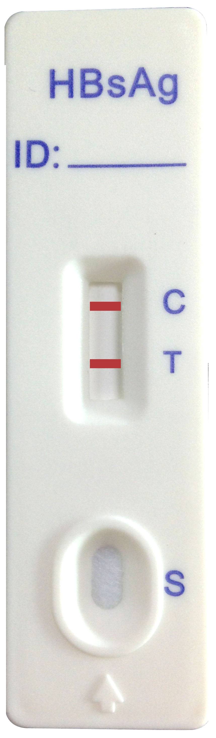 HBsAg Rapid Test Device/Rapid Test/medical Diagnostic Reagent/in-vitro