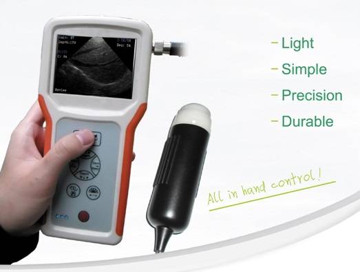 Handheld Portable B Ultrasound Scanner - Lightman Medical Devices Co ...