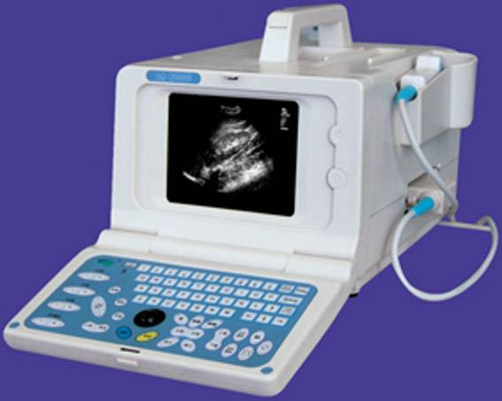 Portable B-Mode Ultrasound Scanner (SQ-2008B) - Jiangsu Xuzhou ShiQi ...