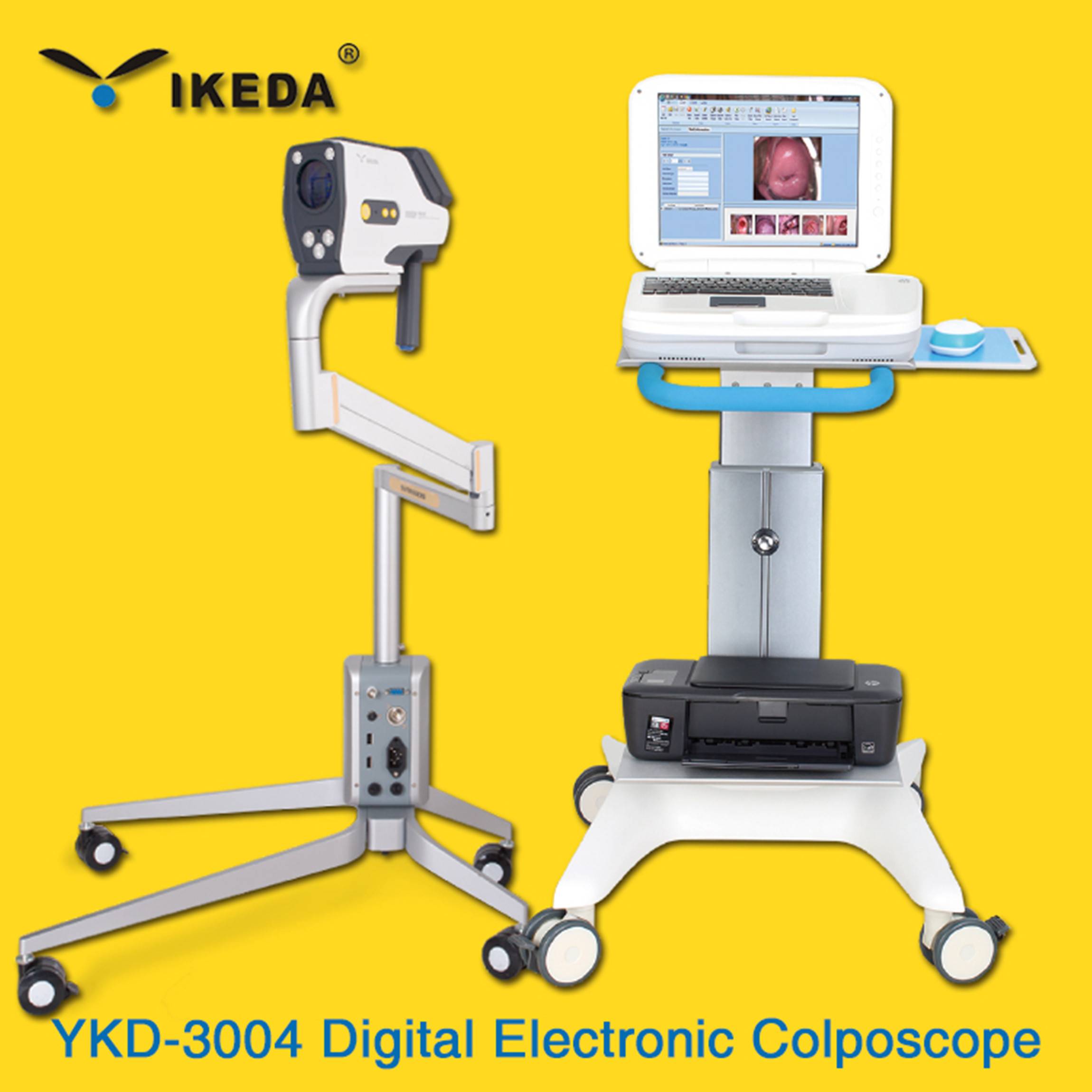 Vaginal Colposcope System Colposcopy Camera Beijing Imagetrec