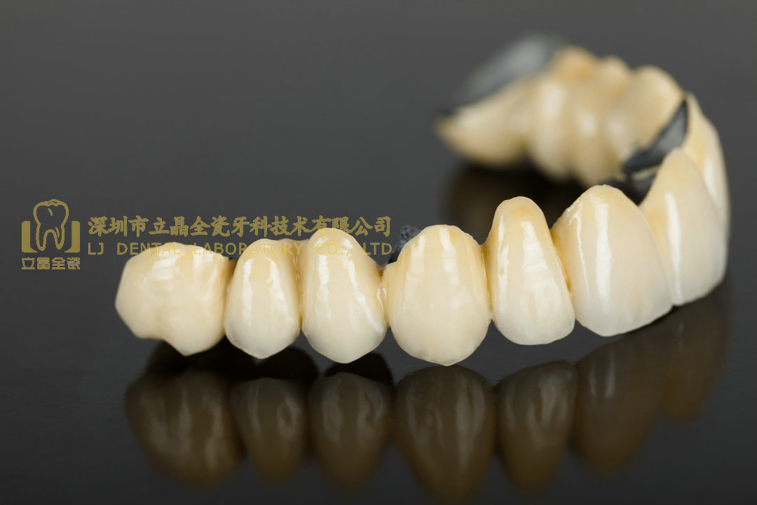 porcelain-crowns-porcelain-bonded-crowns-treatment-care-advice