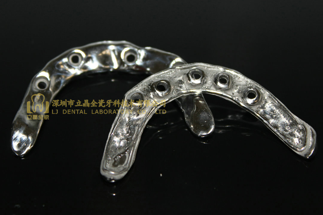 Dental Implant Plate, Implant Bar, Implant Prothesis, Laboratoire ...